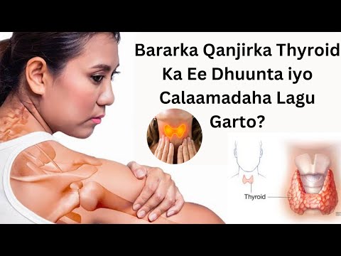 Bararka Qanjirka Thyroid Ka Ee Dhuunta Iyo Calaamadaha Lagu Garto Drabdiaziz