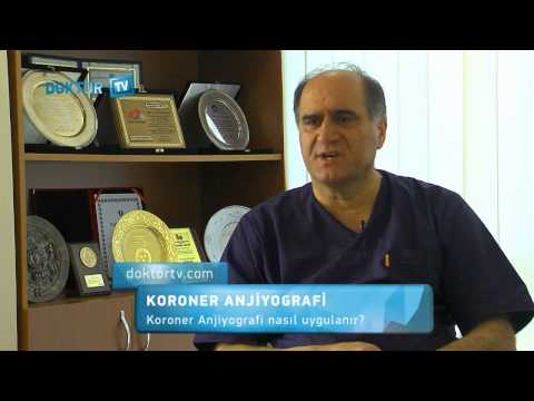 Koroner Anjiyografi Nasıl Uygulanır?