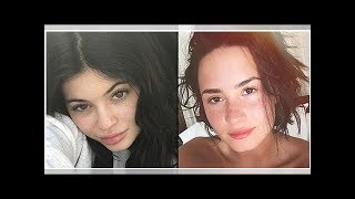 ∞Kylie Jenner, Demi Lovato and More Celebs Flash Their Freckled Faces
