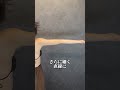 カリカリ二の腕脂肪吸引ダウンタイム１ヶ月は！？#shorts