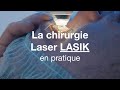 Chirurgie laser lasik  comment a se passe   cof