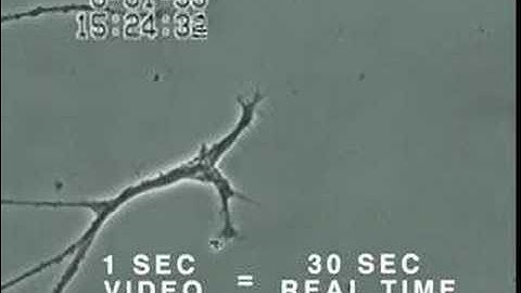 How Mercury Causes Brain Neuron Damage - Uni. of Calgary