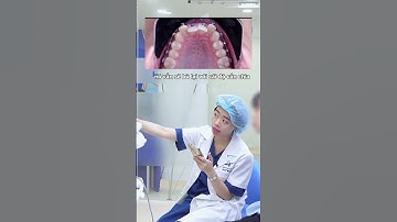 Khớp cắn sâu chỉnh như thế nào?