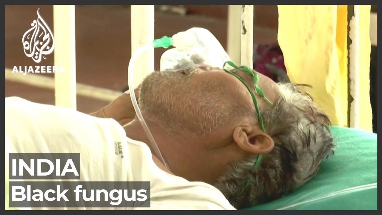 سجلت الهند 259,551 إصابة جديدة بفيروس كورونا، وزاد ظهور "الفطر الأسود" من حدة المشاكل.