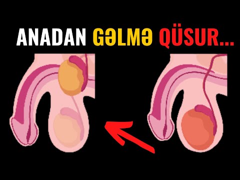 Video: Qışda balkonda nələr və necə saxlanılır?