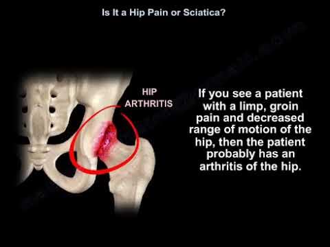 Spine or Hip Pain, Hip joint pain or nerve pain - Everything You