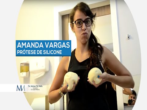 Dr. Moises De Melo | Amanda Vargas - Prótese de silicone