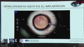 AIOC2026 IC527 - Dr.Sonu Goel - Oops Moments in Phakic Lens