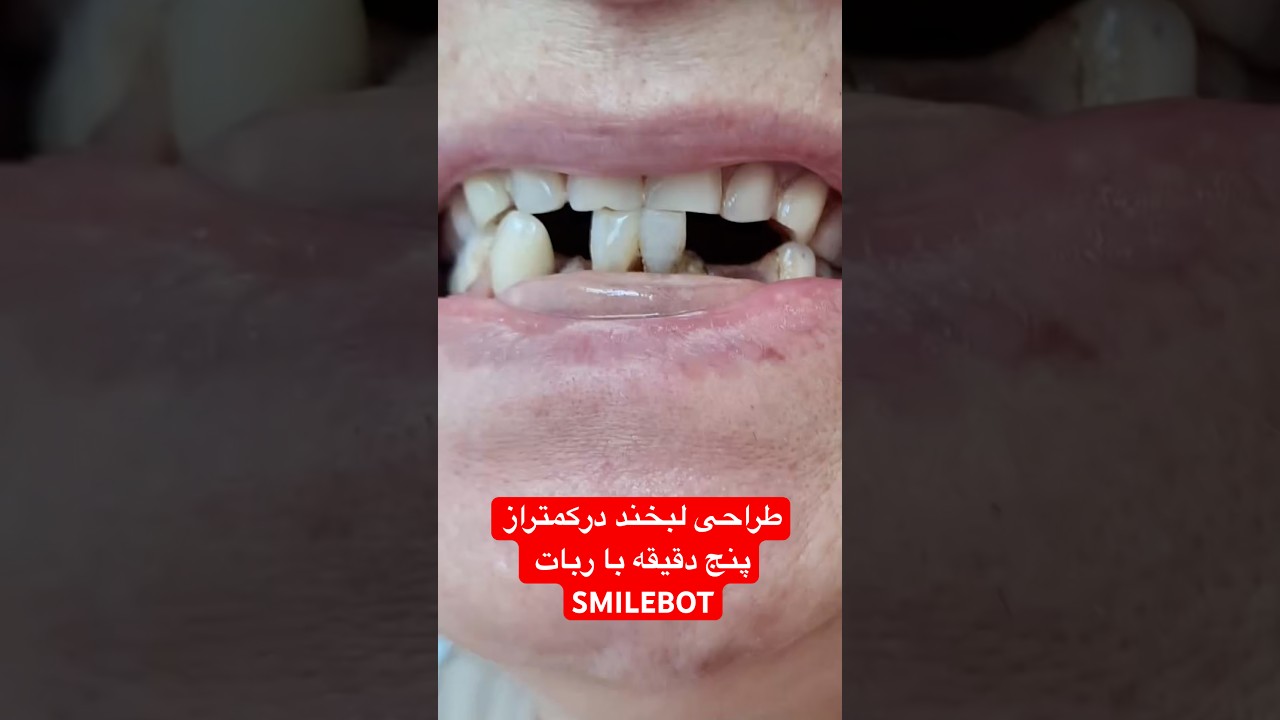 کاور ویدیوی یوتیوب
