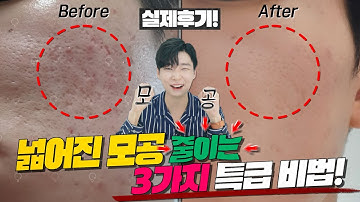 넓어진 모공 줄이는 3가지 특급비법!⚡ l 안보면 손해주의? l 피부는민동성