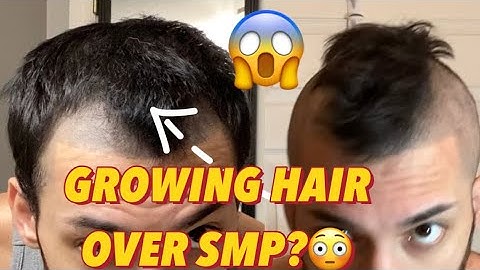 Growing Hair over SMP? (Scalp Micro Pigmentation) Answering questions about my SMP!