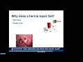 Understanding Recurrent Abdominal & Groin Hernias Why do some hernias come back—even after surgery?