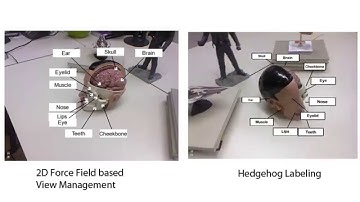 Hedgehog labeling: View management techniques for external labels in 3D space