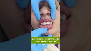Instant Smile Transformation with Zirconia Crowns- Dr. Srishti Bhatia