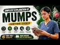Mumps Simplest Explanation | Virology, Clinical Features, Treatment & Prevention, Complications