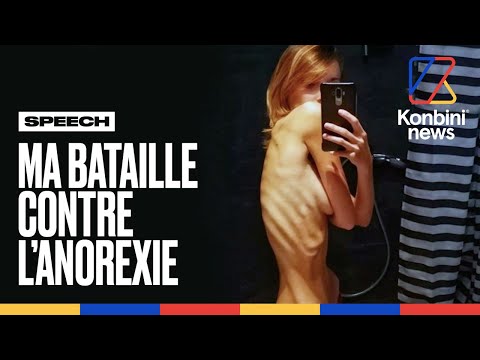 Vidéo: 3 façons de prendre du poids en tant qu'anorexique en convalescence