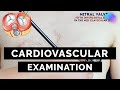 Cardiovascular Examination - OSCE Guide