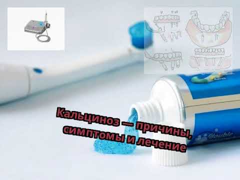 Видео: Отложения кальция в коже: причины, симптомы и методы лечения