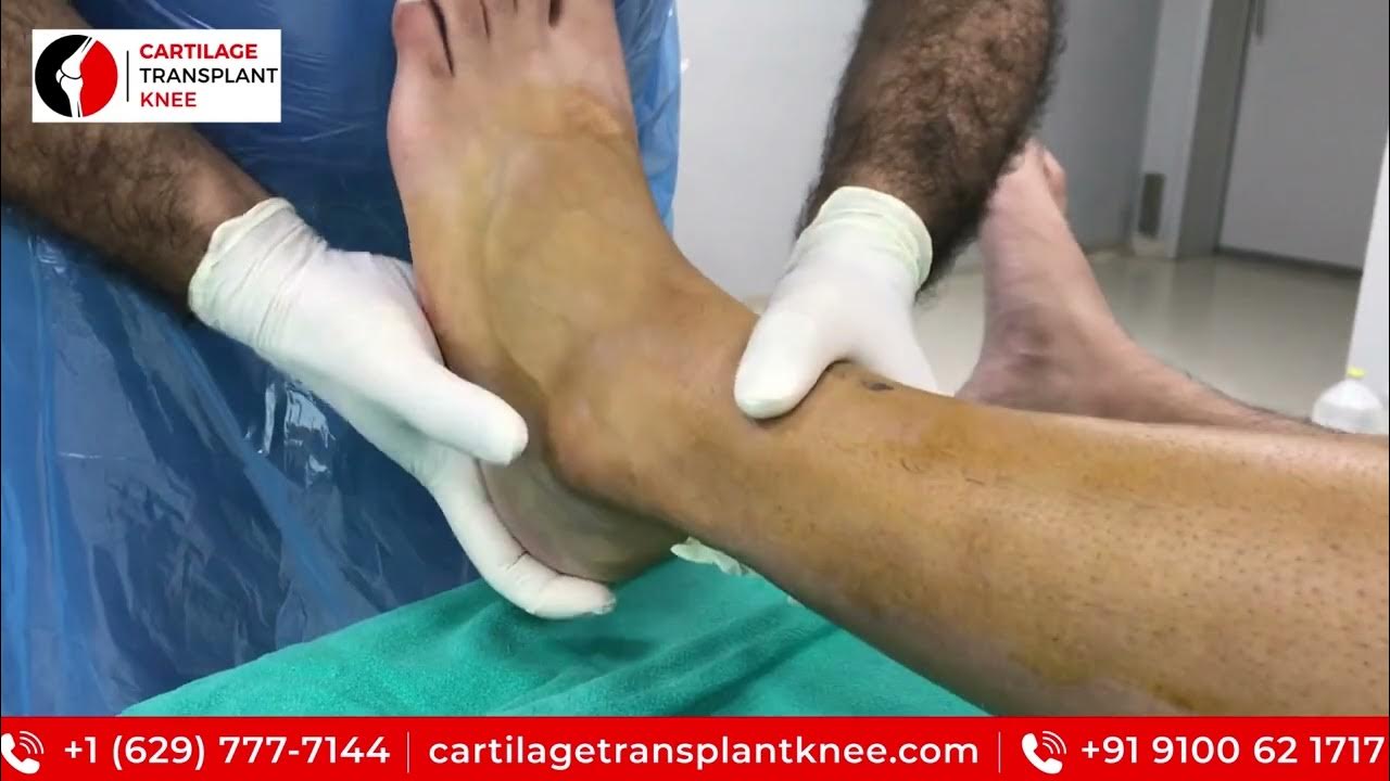 Ankle Surgery Arthroscopic Debridement And Ligament Reconstruction