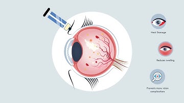 Intravitreal Injections Explained