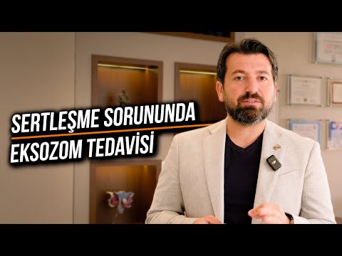 SERTLEŞME SORUNDA YENİ