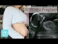 18 weeks pregnant what you need to know  channel mum