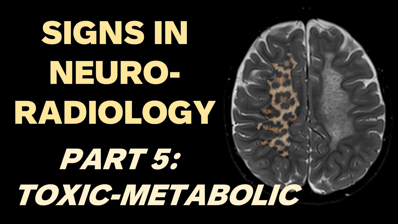Признаки в нейрорадиологии, часть 5: Токсико-метаболические нарушения