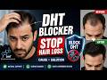 DHT Blocker | (HX-OAAQ) DHT Hairloss Cause | DHT Blockers to stop hairloss | How to Stop Hairloss