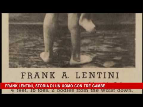 Video: 3 Gambe E 16 Dita: La Storia Di Frank Lentini - Visualizzazione Alternativa