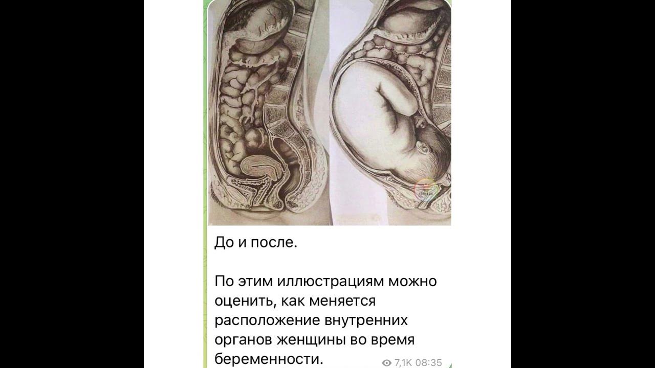 Расположение органов при беременности 3 Welcome to your Second Trimester (part 31)