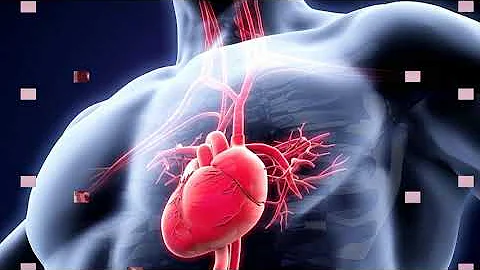 ¿Puede una descarga eléctrica detener el corazón?