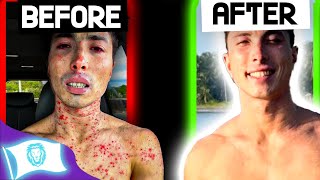 How He Healed his Eczema by Carnivore Revolution 685 views 2 months ago 42 minutes