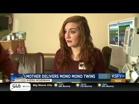 Mother's pregnancy journey with Mono Mono twins - Medical Minute