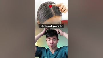 Giảm Đau Nhức Đầu Nhanh Chóng Chỉ Với 3 Huyệt Vị #shorts