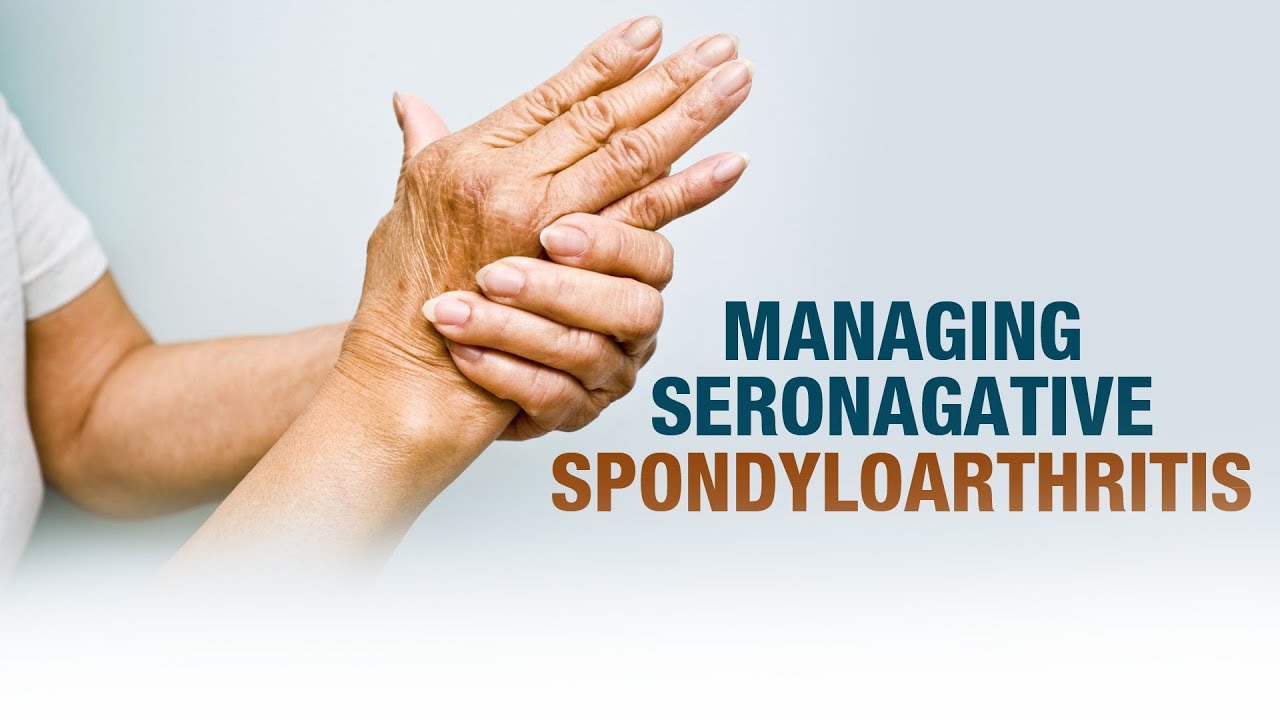 Managing Seronagative Spondyloarthritis Dr. GAurav Sharma Defeating