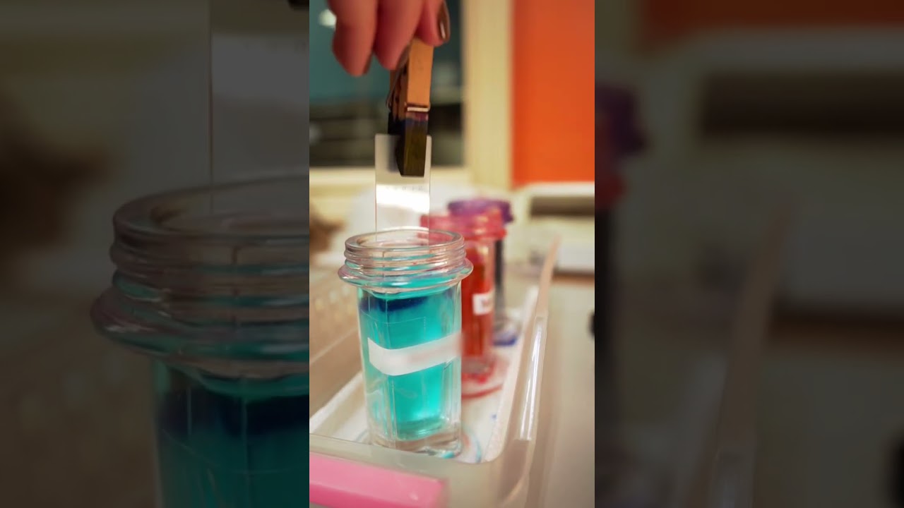 How To Prepare A Urine Sediment Cytology! 