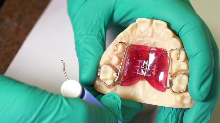 How to adjust your expander