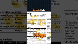 Result Progress Card B-C-A: Using GLP-1!  Dr. S. Balamurugan, explaining his Patient's Report!