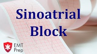 Sinoatrial Block ECG - EMTprep.com