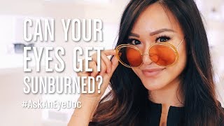 #AskAnEyeDoc: Can Your Eyes Get Sunburned?