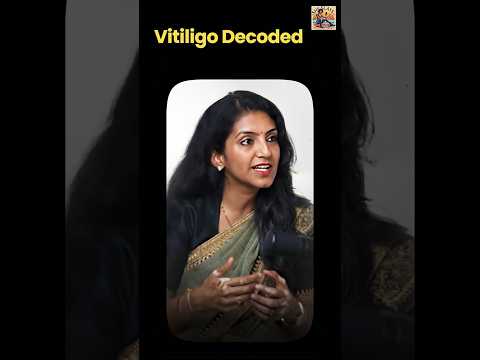 Vitiligo Decoded. What, when, how and its types #shortvideo #vitiligo #supportvitiligo