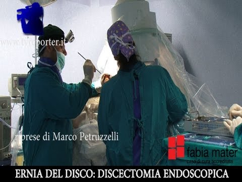 ERNIA DEL DISCO: INTERVENTO IN DIRETTA - A SPINAL DISC HERNIATION