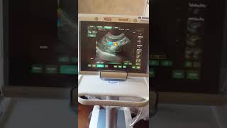 Esaote MyLab ONE VET  |  INMED S.R.L.