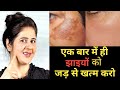 कितनी भी पुरानी झाइयां, pigmentation जड़ से खत्म करें 100% रिजल्ट👌 how to remove pigmentation