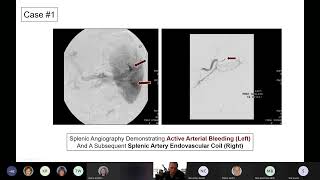 MTAC February 2022: Trauma Case Studies-  Essentials of Early Management