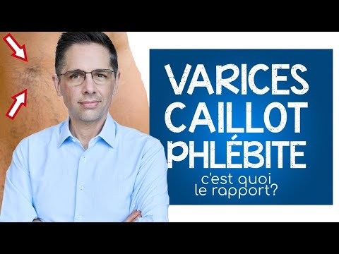 Varices, caillot et phlébite: c'est quoi le rapport ?