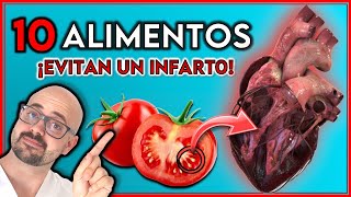 ¡NO más INFARTOS || 10 ALIMENTOS que limpian tus ARTERIAS