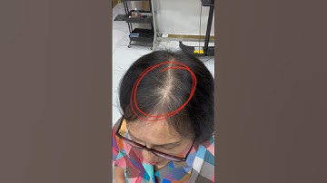 Xem video nếu tóc bạn như này nhé. #xămtóc #xămtóchói