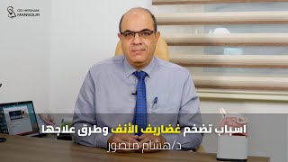 اسباب تضخم غضاريف الأنف وطرق علاجها