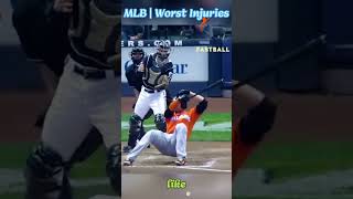 MLB  Worst Injuries #baseball #mlb #funnymoments #sports